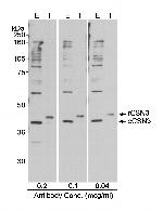 CSN3 Antibody in Western Blot (WB)
