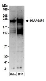 KIAA0460 Polyclonal Antibody