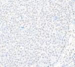 USP7 Polyclonal Antibody