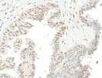 USP7 Antibody in Immunohistochemistry (Paraffin) (IHC (P))