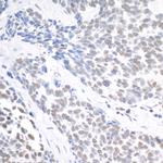 USP7 Polyclonal Antibody