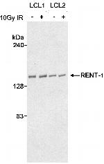 RENT1 Antibody in Western Blot (WB)