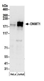 DNMT1 Polyclonal Antibody