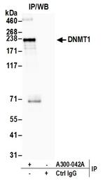DNMT1 Antibody in Immunoprecipitation (IP)