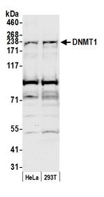 DNMT1 Antibody in Western Blot (WB)