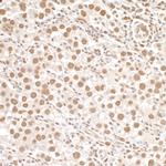 Phospho-SMC1 (Ser966) Antibody in Immunohistochemistry (Paraffin) (IHC (P))