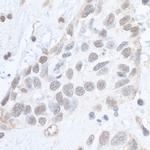 Phospho-SMC1 (Ser966) Antibody in Immunohistochemistry (Paraffin) (IHC (P))