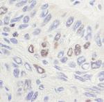 Topo II Alpha Polyclonal Antibody