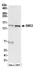SMC2 Polyclonal Antibody