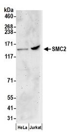 SMC2 Polyclonal Antibody