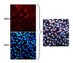 SMC4 Polyclonal Antibody