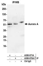 Aurora A Antibody in Immunoprecipitation (IP)