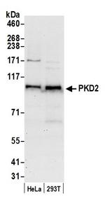 PKD2 Polyclonal Antibody