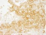 Diaphanous 1 Antibody in Immunohistochemistry (Paraffin) (IHC (P))