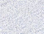 Phospho-gamma-H2AX (Ser139) Antibody in Immunohistochemistry (Paraffin) (IHC (P))