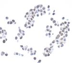 H2AX Antibody in Immunocytochemistry (ICC/IF)