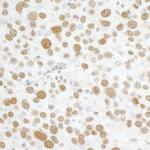 H2AX Antibody in Immunohistochemistry (Paraffin) (IHC (P))
