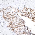 H2AX Antibody in Immunohistochemistry (Paraffin) (IHC (P))