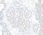H2AX Antibody in Immunohistochemistry (Paraffin) (IHC (P))