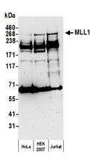 MLL1 Polyclonal Antibody