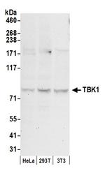 TBK1 Polyclonal Antibody
