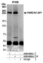 PARC/H7-AP1 Antibody in Immunoprecipitation (IP)