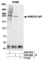 PARC/H7-AP1 Antibody in Immunoprecipitation (IP)