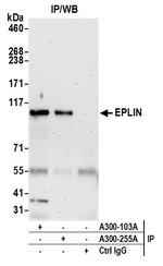 EPLIN Antibody in Immunoprecipitation (IP)