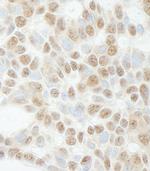 ADNP Antibody in Immunohistochemistry (Paraffin) (IHC (P))