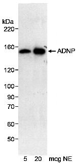 ADNP Antibody in Western Blot (WB)