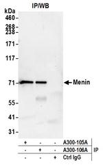 Menin Antibody in Immunoprecipitation (IP)