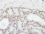 ASH2 Polyclonal Antibody