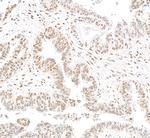 RbBP5 Polyclonal Antibody