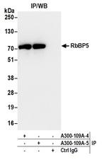 RbBP5 Antibody in Immunoprecipitation (IP)