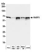 RbBP5 Antibody in Western Blot (WB)