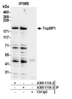 TopBP1 Antibody in Immunoprecipitation (IP)