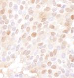 MCM4 Antibody in Immunohistochemistry (Paraffin) (IHC (P))