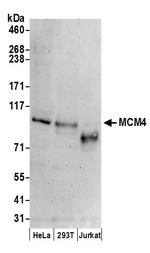 MCM4 Antibody in Western Blot (WB)