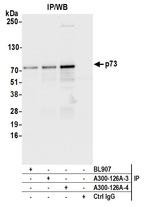 p73 Antibody in Immunoprecipitation (IP)