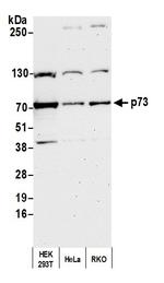 p73 Polyclonal Antibody