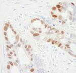 MCM6 Antibody in Immunohistochemistry (Paraffin) (IHC (P))
