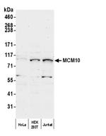 MCM10 Polyclonal Antibody