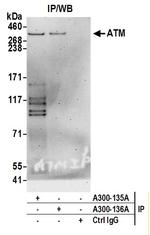 ATM Antibody in Immunoprecipitation (IP)