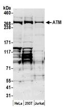ATM Antibody in Western Blot (WB)