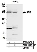 ATR Antibody in Immunoprecipitation (IP)
