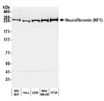 NF1 Polyclonal Antibody