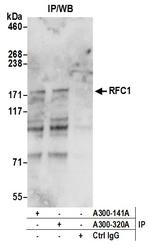 RFC1 Antibody in Immunoprecipitation (IP)