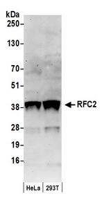 RFC2 Antibody in Western Blot (WB)