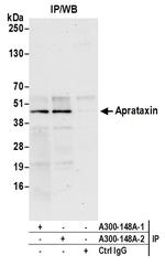 Aprataxin Antibody in Immunoprecipitation (IP)