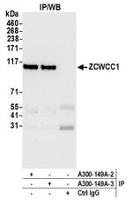ZCWCC1 Antibody in Immunoprecipitation (IP)